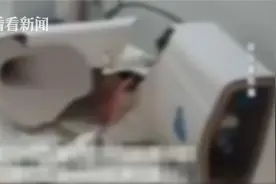 女子正上厕所，马桶突然爆裂……伤口缝了20多针图片