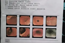 网红“死神辣条“乱象：食用后致伤，有厂家半年前已关闭图片