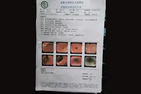 网红“死神辣条“乱象：食用后致伤，有厂家半年前已关闭图片