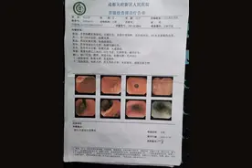 网红“死神辣条”乱象：食用后致伤 有厂家半年前关闭图片