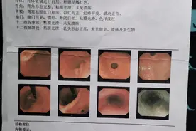 网红“死神辣条”乱象：食用后致伤 有厂家半年前关闭图片