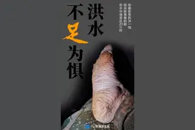 那只让人心疼的脚刷屏后，我们找到了它的主人图片