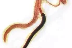 湖北疾控：汛期到了，这个小虫一定要小心图片