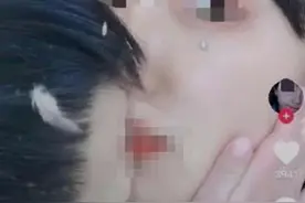 没恶意、男孩不吃亏…“幼师亲吻男童”背后，是被忽视的男童性教育图片