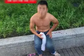 姑娘路边被“赤膊男”压住，大V挺身而出！结果半个耳朵被咬掉图片