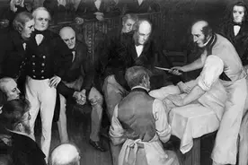 如今必不可少的麻醉，为何在历史上一直得不到使用和普及图片