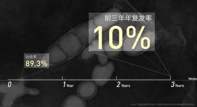 酸爽实验解答为什么你的脚这么臭？