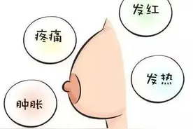 【妇产科普】新手妈妈患乳腺炎可以吃药边喂奶吗？图片