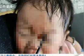 慎买这款“防寂寞”玩具！热销两个月，多名孩子被戳伤眼睛……图片