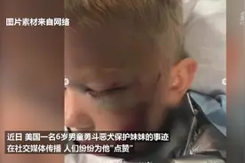美六岁男童勇斗恶犬救妹　获“超级英雄”点赞视频封面