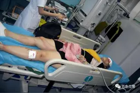 “头”等大事！广西女子骑车未正确戴头盔 致头部被卡围栏图片