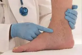 原来这不是一般的水疱啊？图片
