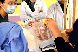 国内首例，上海质子重离子医院开展脉络膜黑色素瘤治疗图片