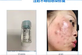 医美专家在线“避雷”这些“变美”手段要不得图片