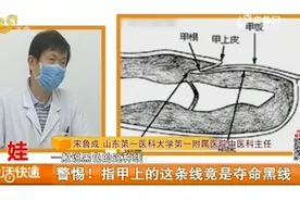 警惕！指甲上的小黑线竟是“致命线”，预示着你的代谢出了大问题视频封面