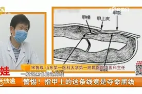 警惕！指甲上的小黑线竟是“致命线”，预示着你的代谢出了大问题视频封面
