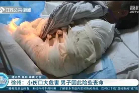 小伤口没往心里去，男子因此险些丧命 输了3000毫升血才救了回来图片