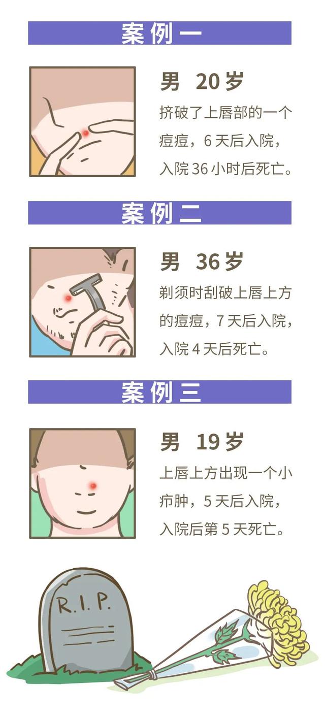 别以为挤痘痘是小事，搞不好会要命的