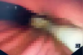 综艺太好笑，女大学生边洗澡边刷综艺，仰天大笑时竟把嘴里牙刷整个吞进去了图片