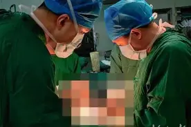 河北省首例！骨肿瘤女童植入3D打印假体，保肢成功图片