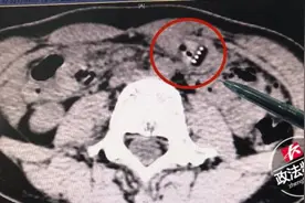 女生边刷牙边看综艺节目，一阵狂笑后把牙刷吞了下去……图片
