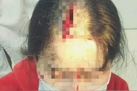 爹爹3楼扔下金属条砸伤女子头部，伤者治疗花费3万多未获赔图片