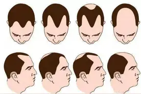 秃如其来的痛？教你挑一款吹风机拯救你的生活图片