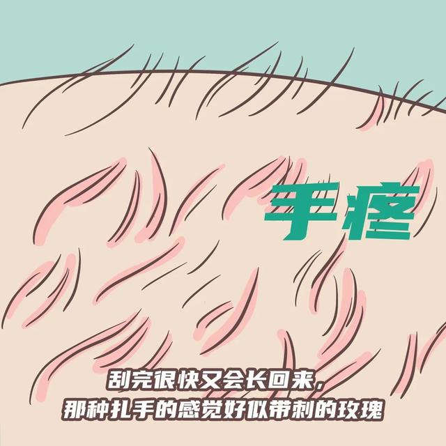 激光脱完毛后可以涂身体乳吗