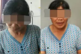 日照市人民医院：不吃药不手术，肉毒毒素注射治疗多种神经类疾病图片
