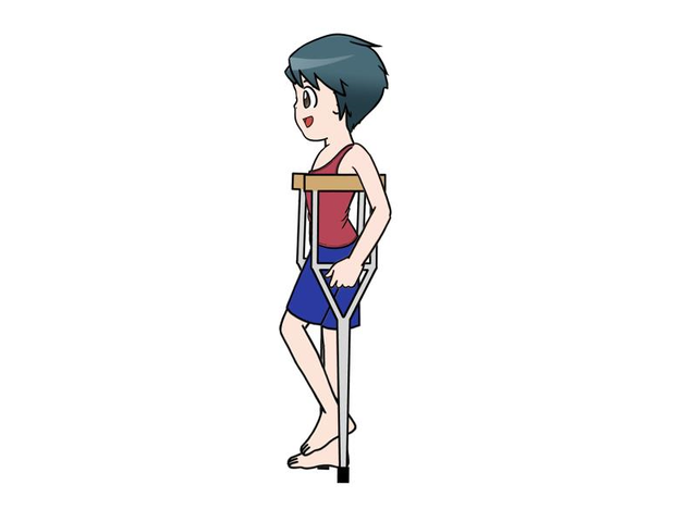 【科普工作委员会】胫骨平台骨折术后该如何正确康复