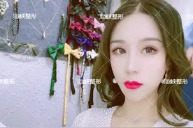 济南自体脂肪填充这样填，才会自然又持久图片