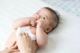 宝宝皮肤特别白时要警惕这种病图片