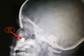 手持小风扇让3岁宝宝进了手术室，这类隐患很多玩具都有图片