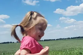 小女孩出生时腹部部分器官外露 依然乐观生活图片