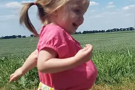 2岁女童内脏外漏依然快乐成长 父母：她特喜欢这个大包 没了咋办？图片