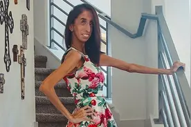“世界最丑女子”反欺凌呼吁 求家长别在抖音上恶搞她的脸吓唬孩子图片