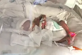 116天精心救治 广州早产龙凤胎连闯“生死关”图片