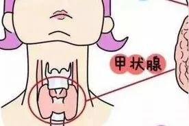 “我好后悔，拿健康换事业！”杭州28岁女白领查出“最懒的癌”，最后拖成癌转移图片