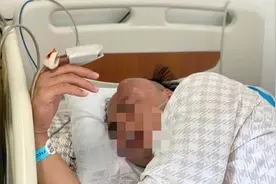 拖了8个月，深圳小伙直径两公分脑瘤变大，占左脑门一半险毁容图片