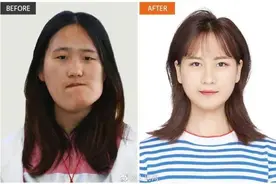 歪脸女孩手术后要回山里当老师图片