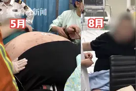 消防“八抬大轿”挪下楼，400斤胖哥切胃减肥，有望减到140公斤图片