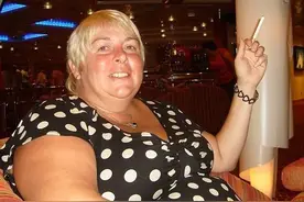 因服药暴胖到127公斤，她做了切胃手术一年后又瘦成了皮包骨图片