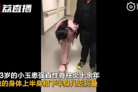 泪目！4次手术折叠女孩终能直立行走：恢复正常后，想自己挣钱养活爸妈图片