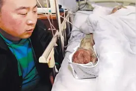 被狗咬了要打疫苗，那被人咬了该怎么办？图片