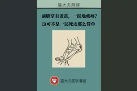 前脚掌起老茧并疼痛？当心这可能是跖痛症图片