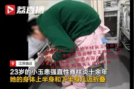 “折叠女孩”4次手术后挺直腰板…这个动作家长一定要会图片