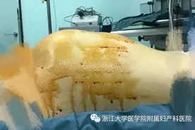 13岁女孩肚子一天天隆起，妈妈反复追问：是不是怀孕了？图片