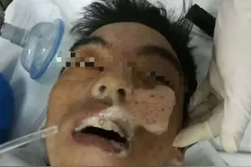 喝下 2 瓶啤酒后，意识模糊口吐血色泡沫，入院抢救无效死亡图片