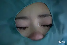 我用七年时间，记录上百个整容者的故事图片