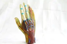 手指断了还能再造新手指？3D全形手指再造了解一下图片